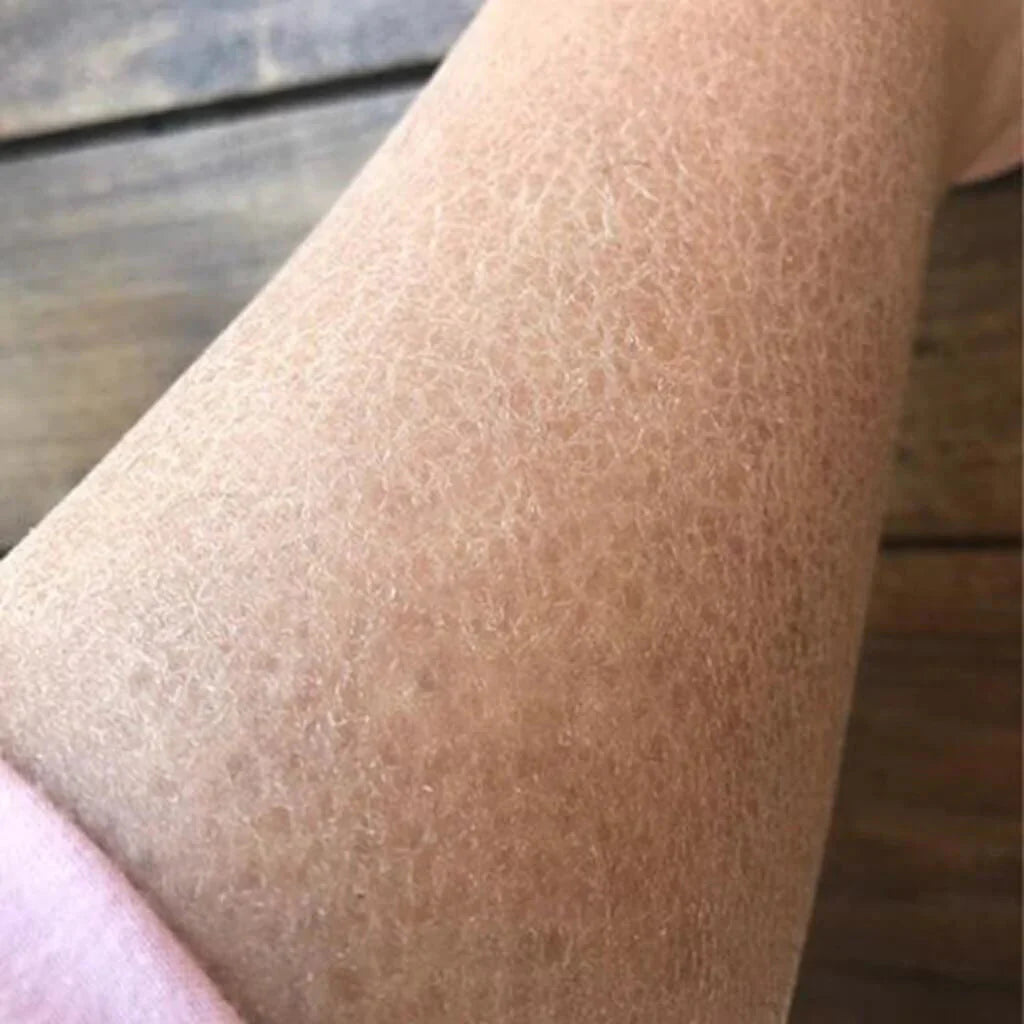 Balaayah Black Gram Bright Body Booster - Firming Body Oil for Dry, Mature Skin - Subscription Body Oil iYURA