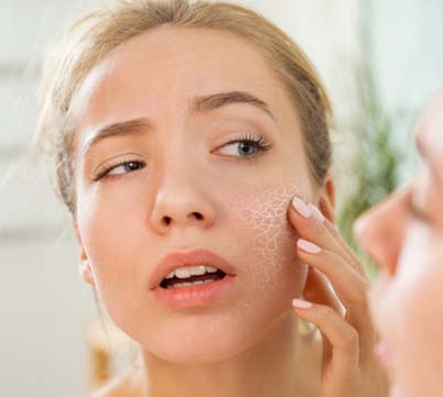 Ayurvedic Products for Dry Skin