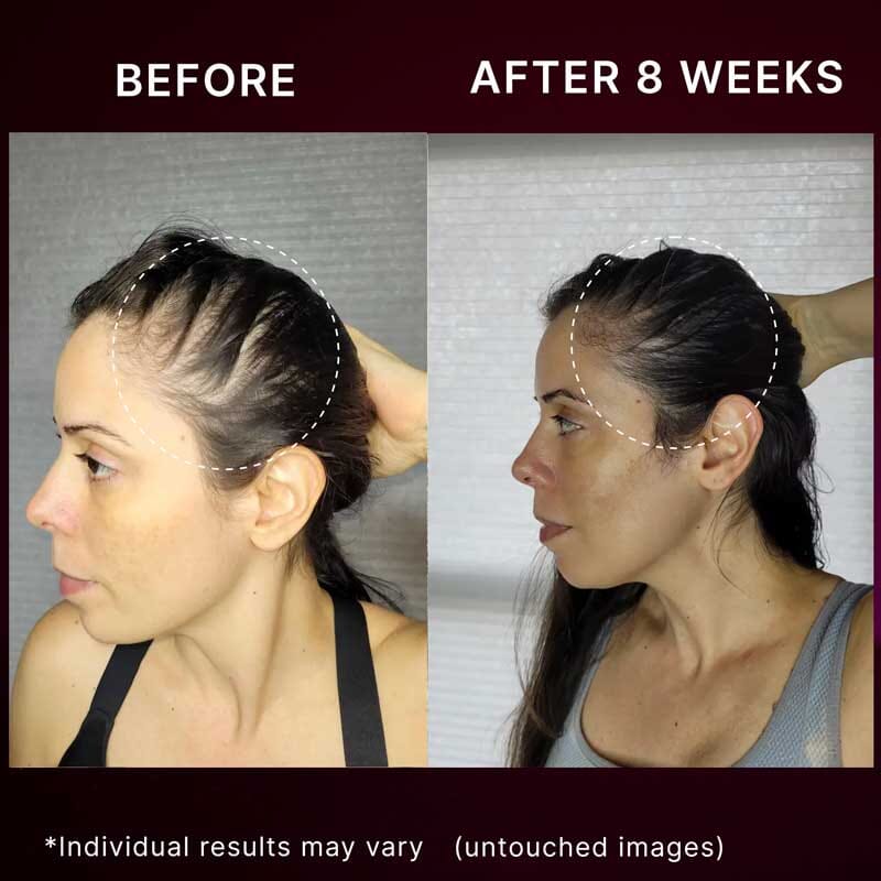 Nail n Mane: Ayurvedic Supplement for Healthy, Strong and Lustrous Hair and Nails Supplements Ayuttva 